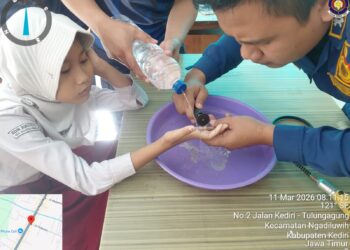 Jari Siswi SD di Ngadiluwih Membengkak Akibat Cincin Mainan, Satpol PP Turun Tangan